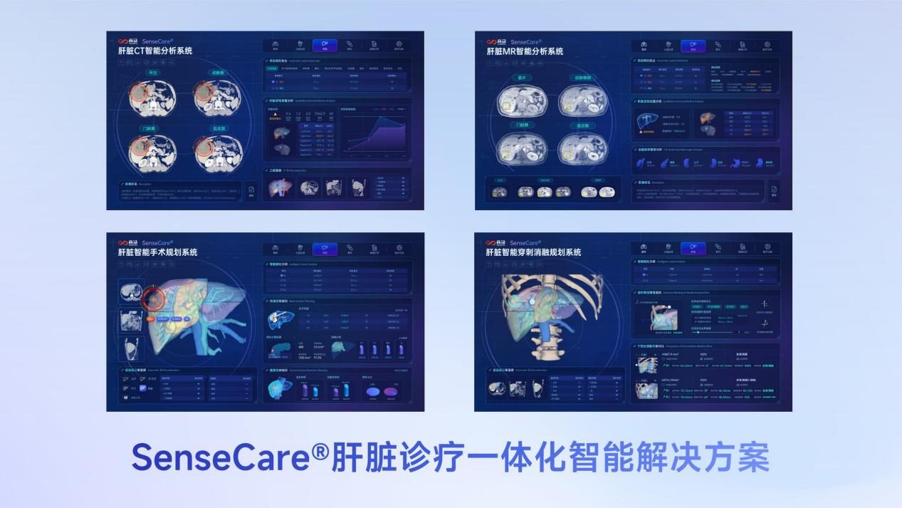 肝脏CT辅助诊断产品首张NMPA三类证出炉！助力肝癌精准诊疗